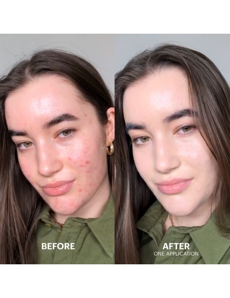 Dr. Jart+ Cicapair Tiger Grass Color Correcting Treatment 15ml