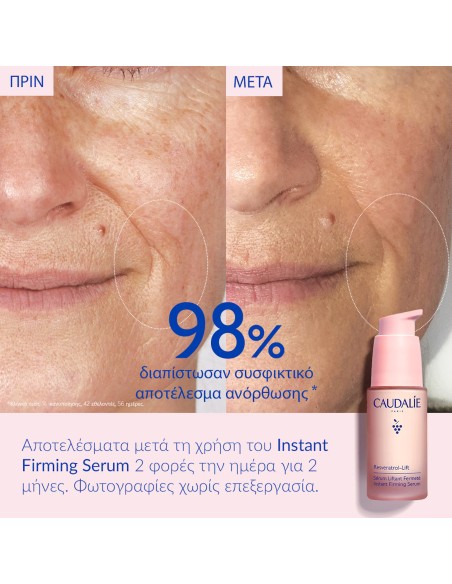 Caudalie Resveratrol Lift Instant Firming Serum Refill 30ml - Ανταλλακτικό Αντιρυτιδικού Συσφικτικού Ορού Προσώπου