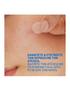 Cerave Blemish Barrier Patches 22-pack 2