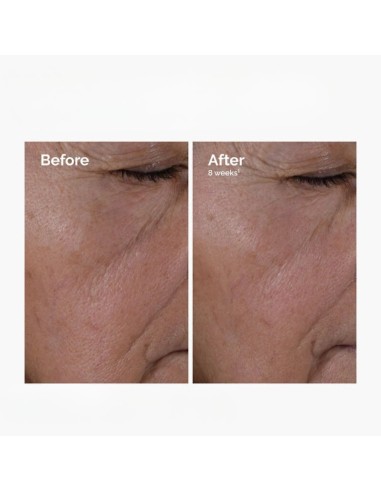 The Ordinary Multi-Peptide + HA Ενυδατικό &...