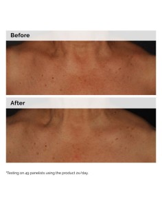 The Ordinary Niacinamide 5% Face & Body Emulsion... 2