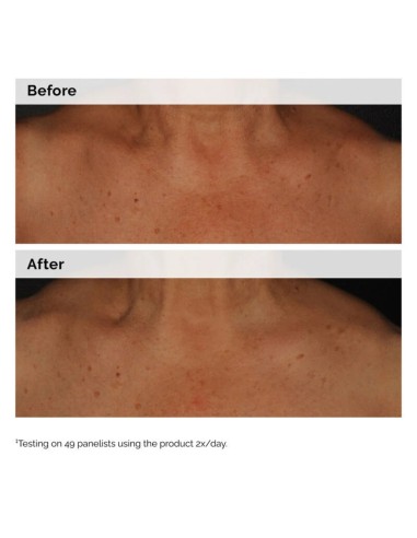 The Ordinary Niacinamide 5% Face and Body...