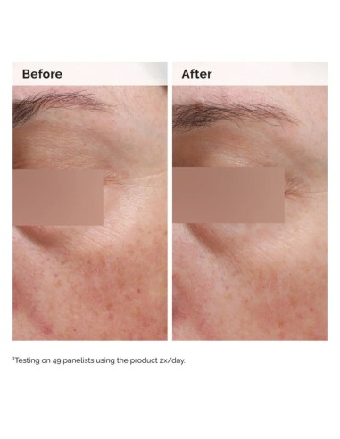 The Ordinary Niacinamide 5% Face and Body...