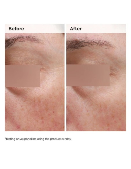 The Ordinary Niacinamide 5% Face and Body Emulsion 100mL