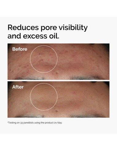 The Ordinary The Ordinary Niacinamide 10% &...