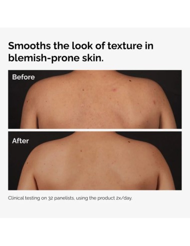 The Ordinary Salicylic Acid 0.5% Body Serum-...