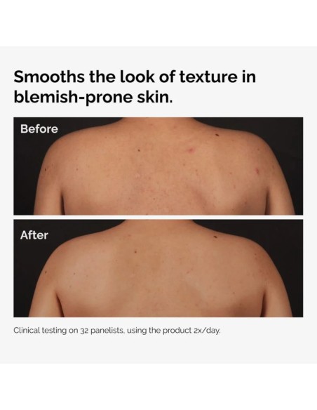 The Ordinary Salicylic Acid 0.5% Body Serum, Απολεπιστικός Ορός Σώματος με Σαλικυλικό Οξύ 240ml