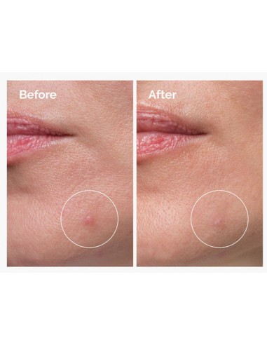 The Ordinary- Sulfur 10% Powder-to-Cream...