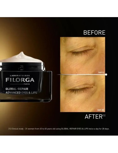 Filorga Global-Repair Advanced Αντιρυτιδική...