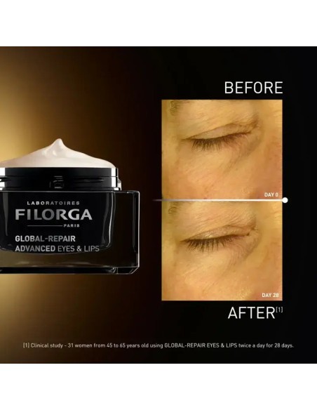 Filorga Global-Repair Advanced Αντιρυτιδική Κρέμα Ματιών & Χειλιών 15 mL
