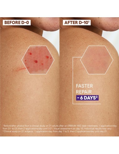 A-Derma Epitheliale Ultra Repair HA+ Cream...