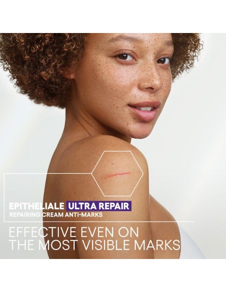A-Derma Epitheliale Ultra Repair HA+ Cream  Επανορθωτική Κρέμα Κατά των Σημαδιών 100ml