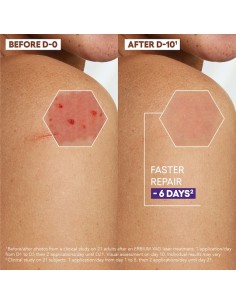 A Derma Epitheliale Ultra Repair HA+ Cream Repairing... 2