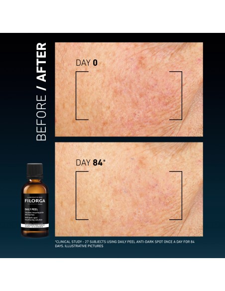 Filorga Daily Peel Anti-Dark Spot Resurfacing Solution 50mL