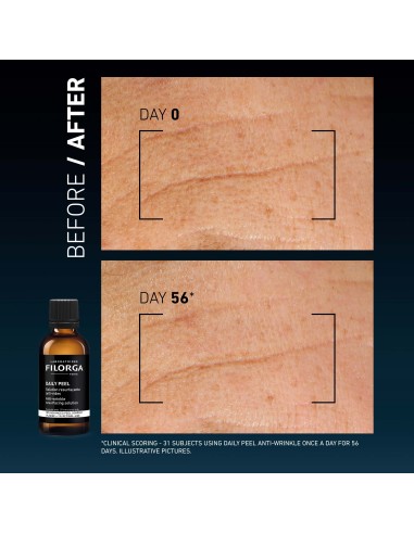 Filorga Daily Peel Anti-Wrinkle Θεραπεία Κατά...