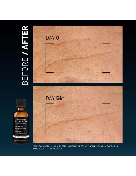 Filorga Daily Peel Anti-Wrinkle Θεραπεία Κατά των Ρυτίδων