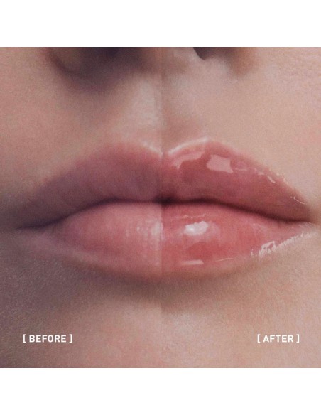 Filorga Hyalu-Filler Lips, Lip Balm για Όγκο 4g