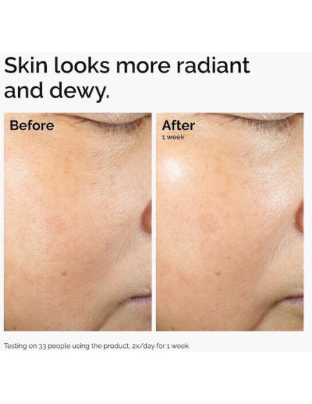 The Ordinary Rise Lipids & Ectoin Microemulsion Κρέμα Προσώπου Ελαφριάς Υφής για Λάμψη & Ενυδάτωση, 60ml
