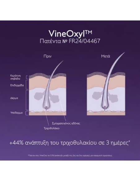 Caudalie Anti-Hair Loss Serum Ορός κατά της Τριχόπτωσης 50ml