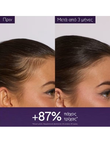 Caudalie Anti-Hair Loss Serum Ορός κατά της...