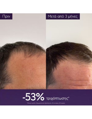 Caudalie Anti-Hair Loss Serum Ορός κατά της...