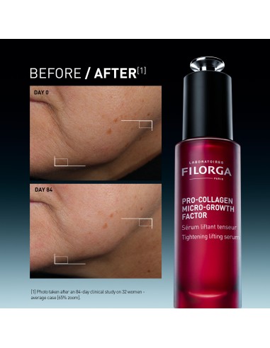 Filorga Pro-Collagen Micro-Growth Factor Serum...