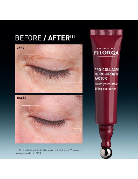 Filorga Pro-Collagen Micro-Growth Factor Lifting Eye Serum- Ορός ματιών 15mL