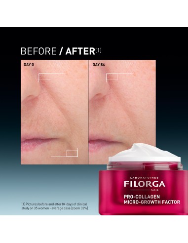Filorga Pro-Collagen Micro-Growth Factor...