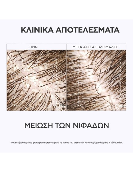 Apivita Dandruff Relief Δερματολογικό Σαμπουάν κατά της Ξηροδερμίας με Propolis AmC & Φυτικό AHA 250ml