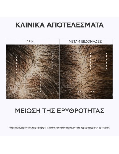 Apivita Dandruff Relief Δερματολογικό Σαμπουάν...