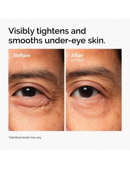 The Ordinary Lacto-PDRN™ 4% + B9 Eye Cream Θρεπτική Κρέμα Ματιών Για Σύσφιξη Ενυδάτωση και Ανόρθωσης  15mL