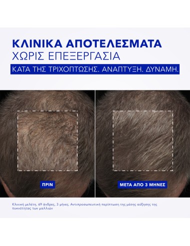 Phyto Phytocyane Intensive+ Treatment for...